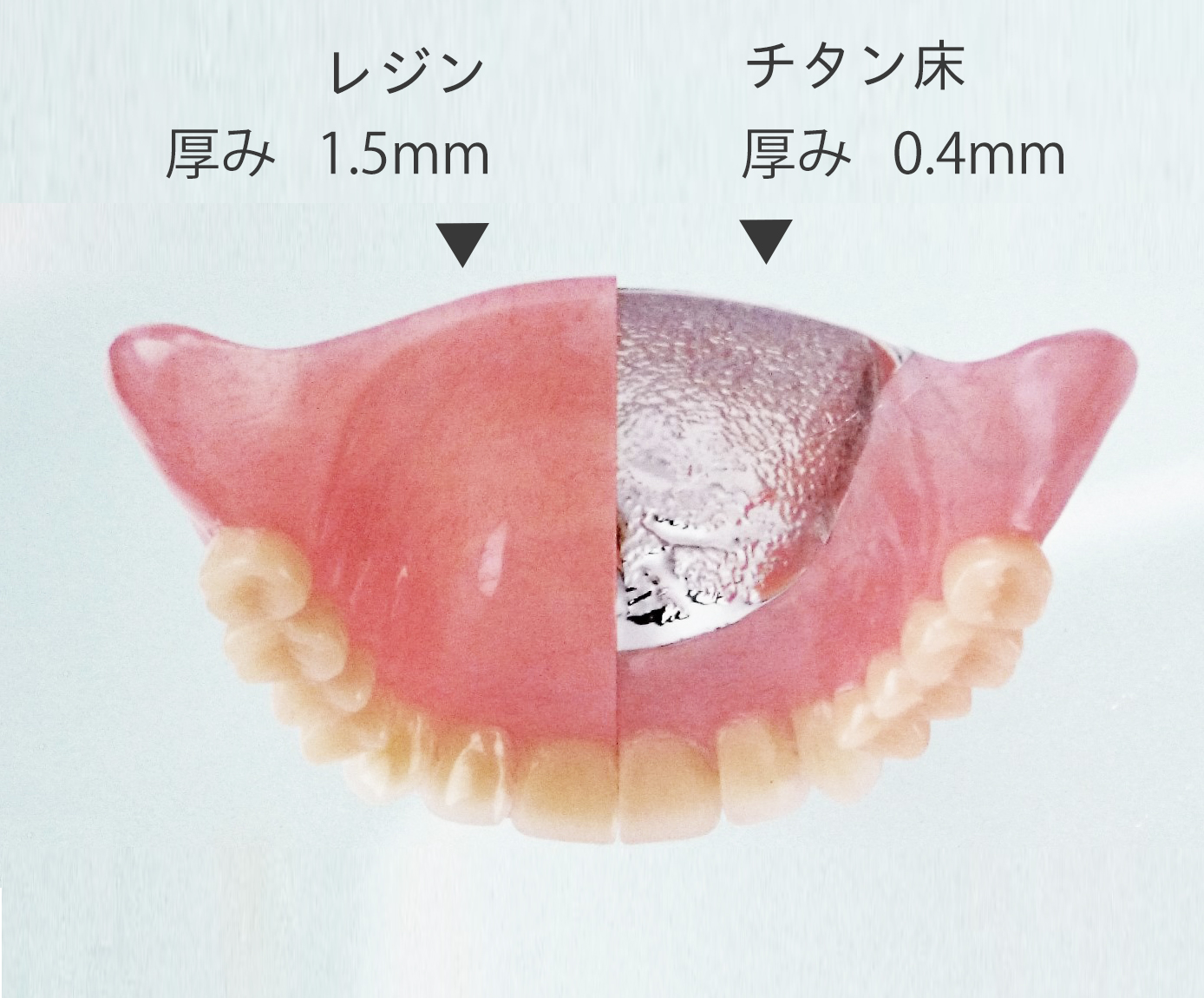 金属床義歯（チタン）