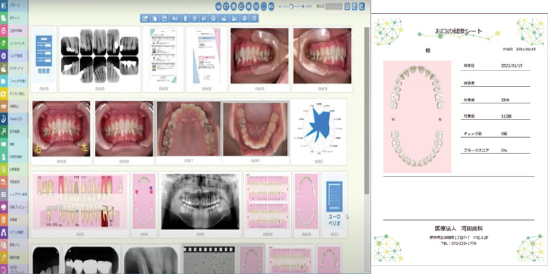 患者様の治療データ、検査データをビジュアル化して管理しています