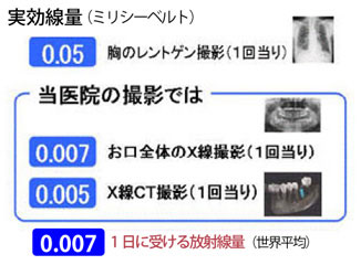 被爆線量は最小限に抑えています