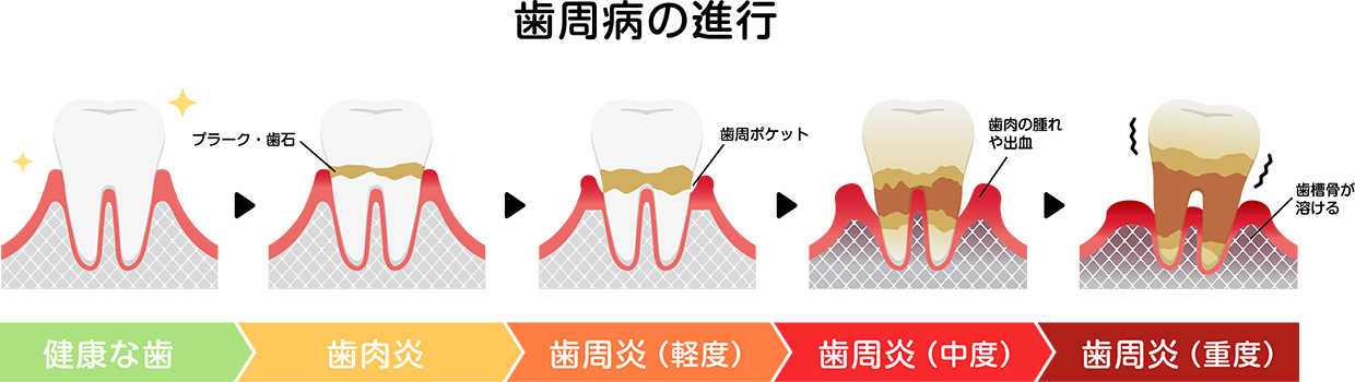 当院では毎回検査結果を患者様へお渡しし、進行具合などをしっかりと管理いたします